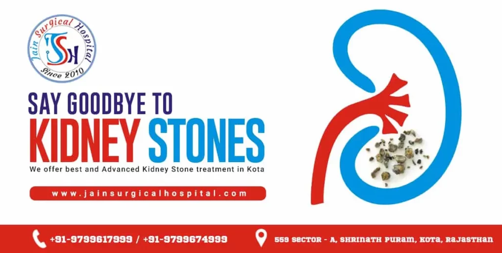 Kidney stones treatment in Kota at the best hospital in Kota. Expert care for kidney stone patients.