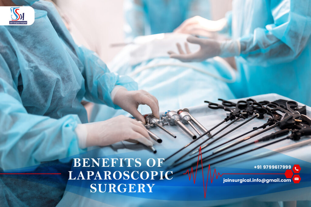 Benefits of laparoscopic surgery: Minimally invasive procedure with shorter recovery time and reduced scarring.