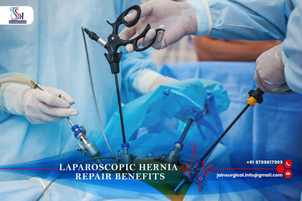 Benefits of laparoscopic hernia repair at the best hernia surgery hospital in Kota.jpg