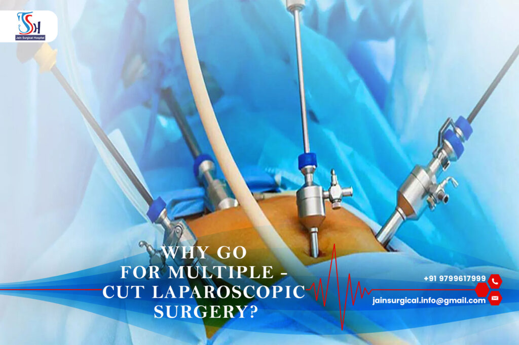   Why go for Multiple - Cut Laparoscopic Surgery?