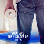 What Are The 4 Stages Of Piles?  
