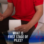 What Is First Stage Of Piles?